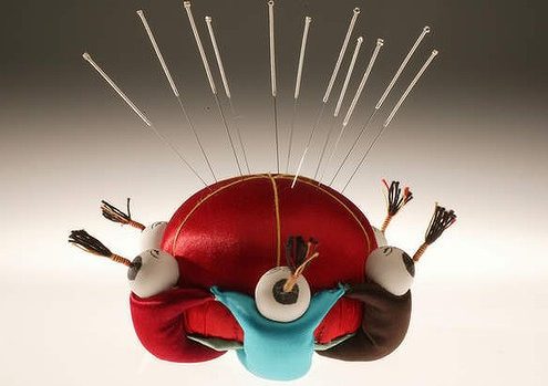 Acupuncture has the potential to help many women. Photo: Natalie Boog