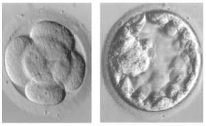 Day 3 and Day 5 embryos