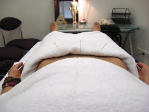  Acupuncture while doing IVF in Westmead