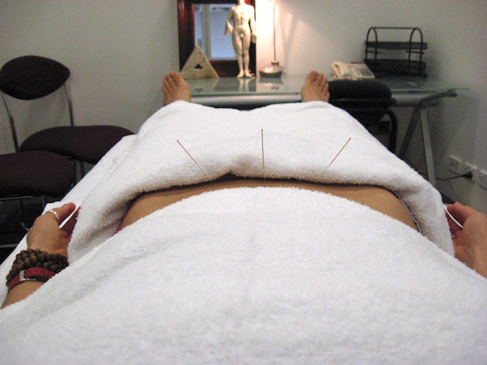 ET acup small for web - Acupuncture Pregnancy Clinic