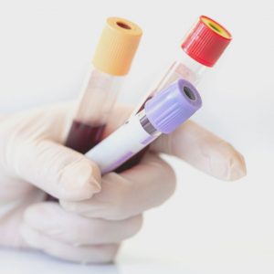 reviewing blood tests