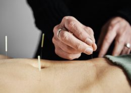 acupuncture in the belly