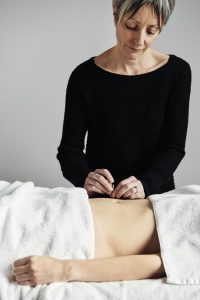Clare Faux providing a fertility acupuncture treatment at Acupuncture Pregnancy Clinic Melbourne 
