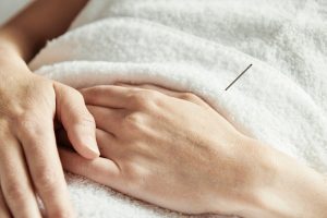 Patient having an acupuncture