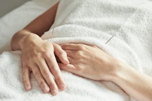 Acupuncture holistic care