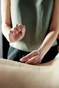 Lauren Gannon providing a fertility acupuncture treatment at Melbourne Acupuncture Pregnancy Clinic