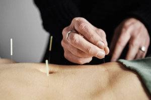 Image of hands performing an acupuncture