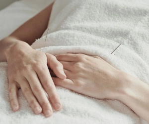 Image of a woman undergoing Acupuncture