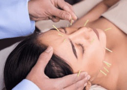 Facial Acupuncture