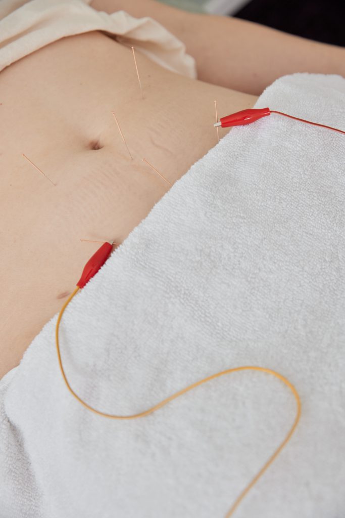 AcupuncturePregnancy-AL-132 - Acupuncture Pregnancy Clinic