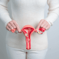 PCOS Endo Women's Reproductive