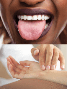 tongue and pulse diagnosis