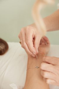 A woman receiving acupuncture treatment A woman receiving acupuncture treatment